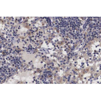 AF0320 at 1/100 staining human lymph node tissue sections by IHC-P. The tissue was formaldehyde fixed and a heat mediated antigen retrieval step in citrate buffer was performed. The tissue was then blocked and incubated with the antibody for 1.5 hours at 22¡ãC. An HRP conjugated goat anti-rabbit antibody was used as the secondary