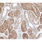 AF0321 at 1/100 staining human kidney tissue sections by IHC-P. The tissue was formaldehyde fixed and a heat mediated antigen retrieval step in citrate buffer was performed. The tissue was then blocked and incubated with the antibody for 1.5 hours at 22¡ãC. An HRP conjugated goat anti-rabbit antibody was used as the secondary