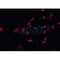 AF0321 staining HeLa  cells by IF/ICC. The sample were fixed with PFA and permeabilized in 0.1% Triton X-100,then blocked in 10% serum for 45 minutes at 25¡ãC. The primary antibody was diluted at 1/200 and incubated with the sample for 1 hour at 37¡ãC. An  Alexa Fluor 594 conjugated goat anti-rabbit IgG (H+L) antibody(Cat.