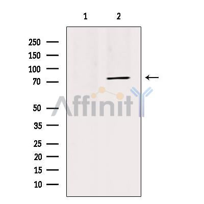 Western blot analysis of extracts from HepG2, using TRI18 Antibody. Lane 1 was treated with the blocking peptide.