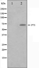 Western blot analysis on Jurkat cell lysate using p73 Antibody.The lane on the left is treated with the antigen-specific peptide.