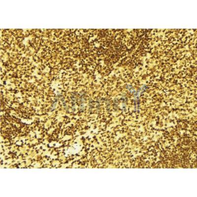 AF0322 at 1/100 staining Mouse spleen tissue by IHC-P. The sample was formaldehyde fixed and a heat mediated antigen retrieval step in citrate buffer was performed. The sample was then blocked and incubated with the antibody for 1.5 hours at 22¡ãC. An HRP conjugated goat anti-rabbit antibody was used as the secondary