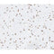 AF0323 at 1/100 staining human brain tissue sections by IHC-P. The tissue was formaldehyde fixed and a heat mediated antigen retrieval step in citrate buffer was performed. The tissue was then blocked and incubated with the antibody for 1.5 hours at 22¡ãC. An HRP conjugated goat anti-rabbit antibody was used as the secondary