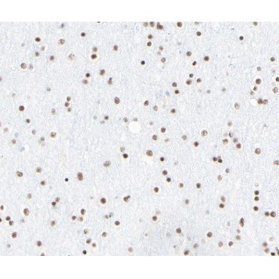 AF0323 at 1/100 staining human brain tissue sections by IHC-P. The tissue was formaldehyde fixed and a heat mediated antigen retrieval step in citrate buffer was performed. The tissue was then blocked and incubated with the antibody for 1.5 hours at 22¡ãC. An HRP conjugated goat anti-rabbit antibody was used as the secondary