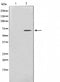 Western blot analysis on HeLa cell lysate using PHF1 Antibody.The lane on the left is treated with the antigen-specific peptide.
