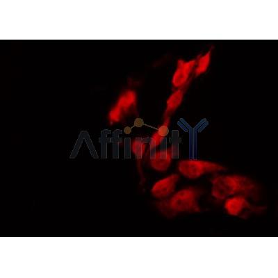 AF0324 staining HeLa by IF/ICC. The sample were fixed with PFA and permeabilized in 0.1% Triton X-100,then blocked in 10% serum for 45 minutes at 25¡ãC. The primary antibody was diluted at 1/200 and incubated with the sample for 1 hour at 37¡ãC. An  Alexa Fluor 594 conjugated goat anti-rabbit IgG (H+L) Ab, diluted at 1/600, was used as the secondary antibod