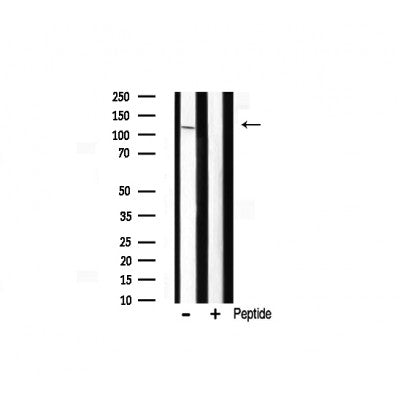 Western blot analysis of M3K13 expression in Mouse brain lysate