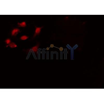 DF3158 staining Hela by IF/ICC. The sample were fixed with PFA and permeabilized in 0.1% Triton X-100,then blocked in 10% serum for 45 minutes at 25¡ãC. The primary antibody was diluted at 1/200 and incubated with the sample for 1 hour at 37¡ãC. An  Alexa Fluor 594 conjugated goat anti-rabbit IgG (H+L) Ab, diluted at 1/600, was used as the secondary antibod