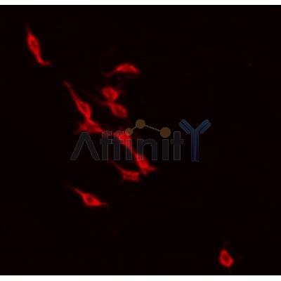 DF3160 staining Hela by IF/ICC. The sample were fixed with PFA and permeabilized in 0.1% Triton X-100,then blocked in 10% serum for 45 minutes at 25¡ãC. The primary antibody was diluted at 1/200 and incubated with the sample for 1 hour at 37¡ãC. An  Alexa Fluor 594 conjugated goat anti-rabbit IgG (H+L) Ab, diluted at 1/600, was used as the secondary antibod