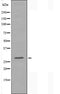 DF3162 staining COLO205 cells by IF/ICC. The sample were fixed with PFA and permeabilized in 0.1% Triton X-100,then blocked in 10% serum for 45 minutes at 25¡ãC. The primary antibody was diluted at 1/200 and incubated with the sample for 1 hour at 37¡ãC. An  Alexa Fluor 594 conjugated goat anti-rabbit IgG (H+L) antibody(Cat.# S0006), diluted at 1/600, was used as secondary antibod