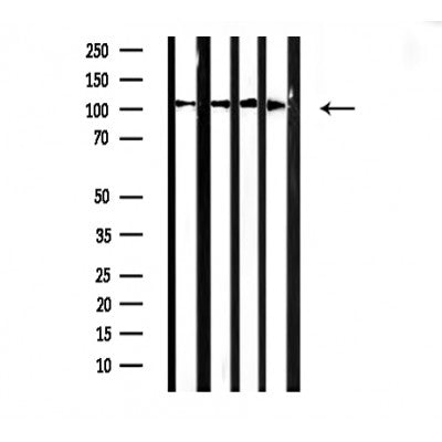 DF3163 at 1/100 staining Mouse muscle tissue by IHC-P. The sample was formaldehyde fixed and a heat mediated antigen retrieval step in citrate buffer was performed. The sample was then blocked and incubated with the antibody for 1.5 hours at 22¡ãC. An HRP conjugated goat anti-rabbit antibody was used as the secondary