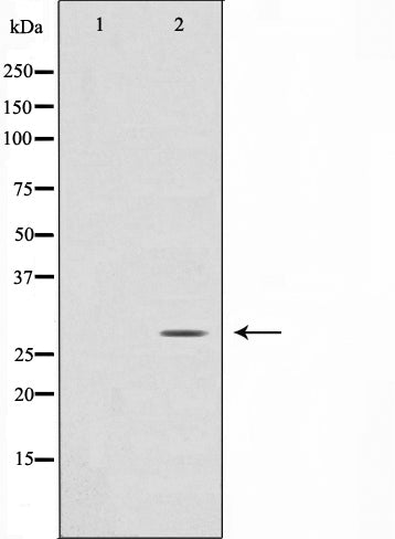 Western blot analysis on HuvEc cell lysate using ANP32C Antibody.The lane on the left is treated with the antigen-specific peptide.