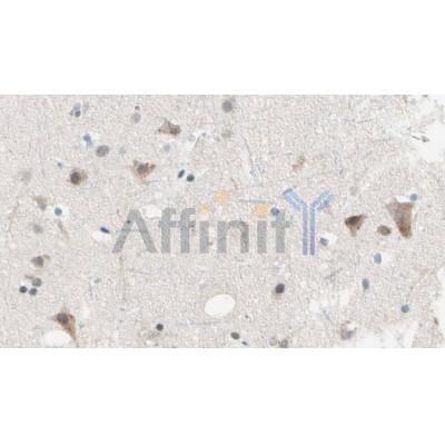 DF3166 staining HepG2 by IF/ICC. The sample were fixed with PFA and permeabilized in 0.1% Triton X-100,then blocked in 10% serum for 45 minutes at 25¡ãC. The primary antibody was diluted at 1/200 and incubated with the sample for 1 hour at 37¡ãC. An  Alexa Fluor 594 conjugated goat anti-rabbit IgG (H+L) Ab, diluted at 1/600, was used as the secondary antibod