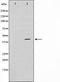Western blot analysis on COLO205 cell lysate using TBX1 Antibody.The lane on the left is treated with the antigen-specific peptide.