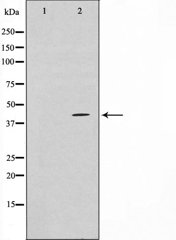 Western blot analysis on COLO205 cell lysate using TBX1 Antibody.The lane on the left is treated with the antigen-specific peptide.