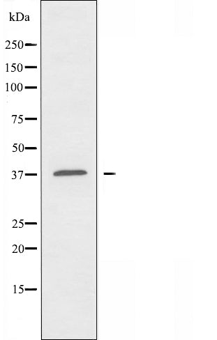 DF3262 staining COLO205 by IF/ICC. The sample were fixed with PFA and permeabilized in 0.1% Triton X-100,then blocked in 10% serum for 45 minutes at 25¡ãC. The primary antibody was diluted at 1/200 and incubated with the sample for 1 hour at 37¡ãC. An  Alexa Fluor 594 conjugated goat anti-rabbit IgG (H+L) Ab, diluted at 1/600, was used as the secondary antibod