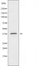 DF3262 staining COLO205 by IF/ICC. The sample were fixed with PFA and permeabilized in 0.1% Triton X-100,then blocked in 10% serum for 45 minutes at 25¡ãC. The primary antibody was diluted at 1/200 and incubated with the sample for 1 hour at 37¡ãC. An  Alexa Fluor 594 conjugated goat anti-rabbit IgG (H+L) Ab, diluted at 1/600, was used as the secondary antibod