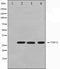 Western blot analysis on HuvEc,Jurkat and 293 cell lysate using TNFSF12 Antibody.The lane on the left is treated with the antigen-specific peptide.