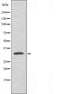 DF3263 staining Hela cells by IF/ICC. The sample were fixed with PFA and permeabilized in 0.1% Triton X-100,then blocked in 10% serum for 45 minutes at 25¡ãC. The primary antibody was diluted at 1/200 and incubated with the sample for 1 hour at 37¡ãC. An  Alexa Fluor 594 conjugated goat anti-rabbit IgG (H+L) antibody(Cat.# S0006), diluted at 1/600, was used as secondary antibod