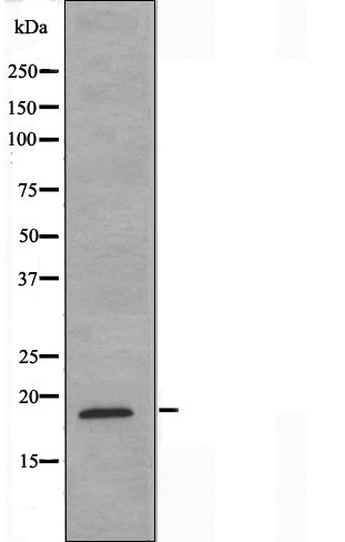 DF3264 staining A549 by IF/ICC. The sample were fixed with PFA and permeabilized in 0.1% Triton X-100,then blocked in 10% serum for 45 minutes at 25¡ãC. The primary antibody was diluted at 1/200 and incubated with the sample for 1 hour at 37¡ãC. An  Alexa Fluor 594 conjugated goat anti-rabbit IgG (H+L) Ab, diluted at 1/600, was used as the secondary antibod