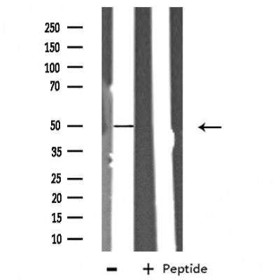 DF3268 staining HeLa cells by IF/ICC. The sample were fixed with PFA and permeabilized in 0.1% Triton X-100,then blocked in 10% serum for 45 minutes at 25¡ãC. The primary antibody was diluted at 1/200 and incubated with the sample for 1 hour at 37¡ãC. An  Alexa Fluor 594 conjugated goat anti-rabbit IgG (H+L) antibody(Cat.# S0006), diluted at 1/600, was used as secondary antibod