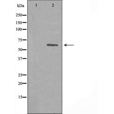 DF3353 staining HepG2 by IF/ICC. The sample were fixed with PFA and permeabilized in 0.1% Triton X-100,then blocked in 10% serum for 45 minutes at 25¡ãC. The primary antibody was diluted at 1/200 and incubated with the sample for 1 hour at 37¡ãC. An  Alexa Fluor 594 conjugated goat anti-rabbit IgG (H+L) Ab, diluted at 1/600, was used as the secondary antibod