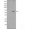 DF3353 staining HepG2 by IF/ICC. The sample were fixed with PFA and permeabilized in 0.1% Triton X-100,then blocked in 10% serum for 45 minutes at 25¡ãC. The primary antibody was diluted at 1/200 and incubated with the sample for 1 hour at 37¡ãC. An  Alexa Fluor 594 conjugated goat anti-rabbit IgG (H+L) Ab, diluted at 1/600, was used as the secondary antibod