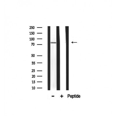 Western blot analysis on mouse muscle lysate using AKAP10 Antibody