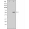 DF3355 at 1/100 staining Mouse lung tissue by IHC-P. The sample was formaldehyde fixed and a heat mediated antigen retrieval step in citrate buffer was performed. The sample was then blocked and incubated with the antibody for 1.5 hours at 22¡ãC. An HRP conjugated goat anti-rabbit antibody was used as the secondary