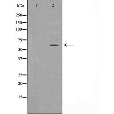 DF3356 staining  HeLa cells by IF/ICC. The sample were fixed with PFA and permeabilized in 0.1% Triton X-100,then blocked in 10% serum for 45 minutes at 25¡ãC. The primary antibody was diluted at 1/200 and incubated with the sample for 1 hour at 37¡ãC. An  Alexa Fluor 594 conjugated goat anti-rabbit IgG (H+L) antibody(Cat.# S0006), diluted at 1/600, was used as secondary antibod