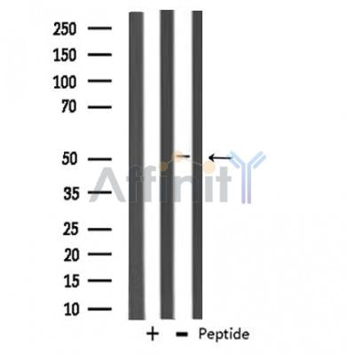Western blot analysis of extracts from 293, using ADCK3 Antibody.
