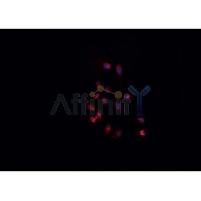 AF0333 staining Daudi cells by IF/ICC. The sample were fixed with PFA and permeabilized in 0.1% Triton X-100,then blocked in 10% serum for 45 minutes at 25¡ãC. The primary antibody was diluted at 1/200 and incubated with the sample for 1 hour at 37¡ãC. An  Alexa Fluor 594 conjugated goat anti-rabbit IgG (H+L) antibody(Cat.