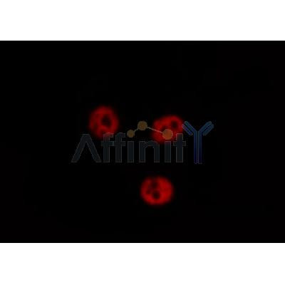 AF0333 staining Hela by IF/ICC. The sample were fixed with PFA and permeabilized in 0.1% Triton X-100,then blocked in 10% serum for 45 minutes at 25¡ãC. The primary antibody was diluted at 1/200 and incubated with the sample for 1 hour at 37¡ãC. An  Alexa Fluor 594 conjugated goat anti-rabbit IgG (H+L) Ab, diluted at 1/600, was used as the secondary antibod