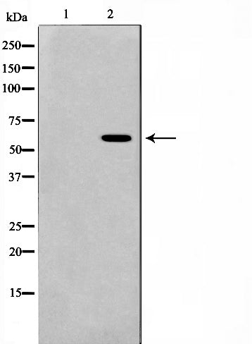 Western blot analysis on HeLa cell lysate using AIRE Antibody,The lane on the left is treated with the antigen-specific peptide.
