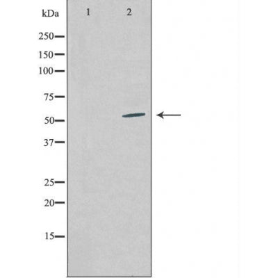 DF3222 staining  Hela cells by IF/ICC. The sample were fixed with PFA and permeabilized in 0.1% Triton X-100,then blocked in 10% serum for 45 minutes at 25¡ãC. The primary antibody was diluted at 1/200 and incubated with the sample for 1 hour at 37¡ãC. An  Alexa Fluor 594 conjugated goat anti-rabbit IgG (H+L) antibody(Cat.# S0006), diluted at 1/600, was used as secondary antibod