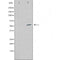 DF3222 staining  Hela cells by IF/ICC. The sample were fixed with PFA and permeabilized in 0.1% Triton X-100,then blocked in 10% serum for 45 minutes at 25¡ãC. The primary antibody was diluted at 1/200 and incubated with the sample for 1 hour at 37¡ãC. An  Alexa Fluor 594 conjugated goat anti-rabbit IgG (H+L) antibody(Cat.# S0006), diluted at 1/600, was used as secondary antibod