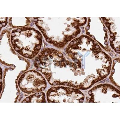 DF3229 staining LOVO by IF/ICC. The sample were fixed with PFA and permeabilized in 0.1% Triton X-100,then blocked in 10% serum for 45 minutes at 25¡ãC. The primary antibody was diluted at 1/200 and incubated with the sample for 1 hour at 37¡ãC. An  Alexa Fluor 594 conjugated goat anti-rabbit IgG (H+L) Ab, diluted at 1/600, was used as the secondary antibod