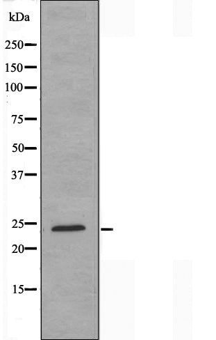 DF3230 staining HeLa cells by IF/ICC. The sample were fixed with PFA and permeabilized in 0.1% Triton X-100,then blocked in 10% serum for 45 minutes at 25¡ãC. The primary antibody was diluted at 1/200 and incubated with the sample for 1 hour at 37¡ãC. An  Alexa Fluor 594 conjugated goat anti-rabbit IgG (H+L) antibody(Cat.# S0006), diluted at 1/600, was used as secondary antibod
