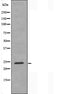DF3230 staining HeLa cells by IF/ICC. The sample were fixed with PFA and permeabilized in 0.1% Triton X-100,then blocked in 10% serum for 45 minutes at 25¡ãC. The primary antibody was diluted at 1/200 and incubated with the sample for 1 hour at 37¡ãC. An  Alexa Fluor 594 conjugated goat anti-rabbit IgG (H+L) antibody(Cat.# S0006), diluted at 1/600, was used as secondary antibod