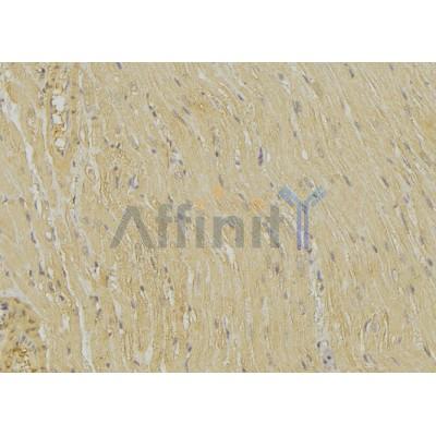 DF3232 staining Hela by IF/ICC. The sample were fixed with PFA and permeabilized in 0.1% Triton X-100,then blocked in 10% serum for 45 minutes at 25¡ãC. The primary antibody was diluted at 1/200 and incubated with the sample for 1 hour at 37¡ãC. An  Alexa Fluor 594 conjugated goat anti-rabbit IgG (H+L) Ab, diluted at 1/600, was used as the secondary antibod