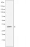 DF3237 staining Hela cells by IF/ICC. The sample were fixed with PFA and permeabilized in 0.1% Triton X-100,then blocked in 10% serum for 45 minutes at 25¡ãC. The primary antibody was diluted at 1/200 and incubated with the sample for 1 hour at 37¡ãC. An  Alexa Fluor 594 conjugated goat anti-rabbit IgG (H+L) antibody(Cat.# S0006), diluted at 1/600, was used as secondary antibod