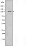 DF3239 staining LOVO by IF/ICC. The sample were fixed with PFA and permeabilized in 0.1% Triton X-100,then blocked in 10% serum for 45 minutes at 25¡ãC. The primary antibody was diluted at 1/200 and incubated with the sample for 1 hour at 37¡ãC. An  Alexa Fluor 594 conjugated goat anti-rabbit IgG (H+L) Ab, diluted at 1/600, was used as the secondary antibod