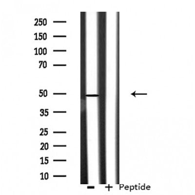 DF3241 staining Hela by IF/ICC. The sample were fixed with PFA and permeabilized in 0.1% Triton X-100,then blocked in 10% serum for 45 minutes at 25¡ãC. The primary antibody was diluted at 1/200 and incubated with the sample for 1 hour at 37¡ãC. An  Alexa Fluor 594 conjugated goat anti-rabbit IgG (H+L) Ab, diluted at 1/600, was used as the secondary antibod