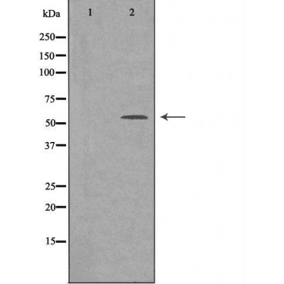 DF3245 staining LOVO cells by IF/ICC. The sample were fixed with PFA and permeabilized in 0.1% Triton X-100,then blocked in 10% serum for 45 minutes at 25¡ãC. The primary antibody was diluted at 1/200 and incubated with the sample for 1 hour at 37¡ãC. An  Alexa Fluor 594 conjugated goat anti-rabbit IgG (H+L) antibody(Cat.# S0006), diluted at 1/600, was used as secondary antibod