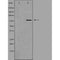 DF3246 staining  HT29 cells by IF/ICC. The sample were fixed with PFA and permeabilized in 0.1% Triton X-100,then blocked in 10% serum for 45 minutes at 25¡ãC. The primary antibody was diluted at 1/200 and incubated with the sample for 1 hour at 37¡ãC. An  Alexa Fluor 594 conjugated goat anti-rabbit IgG (H+L) antibody(Cat.# S0006), diluted at 1/600, was used as secondary antibod