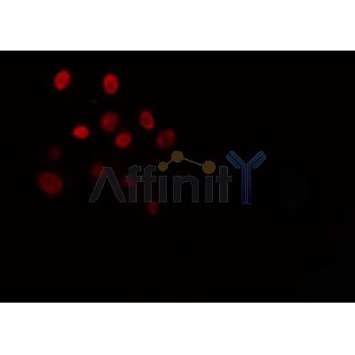 Western blot analysis of extracts from rat heart, using TEF Antibody.