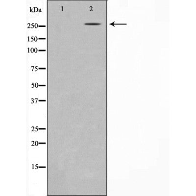 DF3249 at 1/100 staining Mouse lung tissue by IHC-P. The sample was formaldehyde fixed and a heat mediated antigen retrieval step in citrate buffer was performed. The sample was then blocked and incubated with the antibody for 1.5 hours at 22¡ãC. An HRP conjugated goat anti-rabbit antibody was used as the secondary