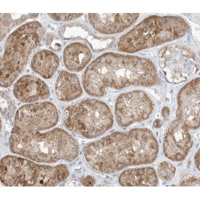 AF0106 at 1/100 staining human kidney tissue sections by IHC-P. The tissue was formaldehyde fixed and a heat mediated antigen retrieval step in citrate buffer was performed. The tissue was then blocked and incubated with the antibody for 1.5 hours at 22¡ãC. An HRP conjugated goat anti-rabbit antibody was used as the secondary