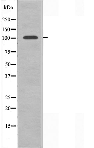 DF3256 staining  COLO205 cells by IF/ICC. The sample were fixed with PFA and permeabilized in 0.1% Triton X-100,then blocked in 10% serum for 45 minutes at 25¡ãC. The primary antibody was diluted at 1/200 and incubated with the sample for 1 hour at 37¡ãC. An  Alexa Fluor 594 conjugated goat anti-rabbit IgG (H+L) antibody(Cat.# S0006), diluted at 1/600, was used as secondary antibod