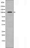DF3256 staining  COLO205 cells by IF/ICC. The sample were fixed with PFA and permeabilized in 0.1% Triton X-100,then blocked in 10% serum for 45 minutes at 25¡ãC. The primary antibody was diluted at 1/200 and incubated with the sample for 1 hour at 37¡ãC. An  Alexa Fluor 594 conjugated goat anti-rabbit IgG (H+L) antibody(Cat.# S0006), diluted at 1/600, was used as secondary antibod